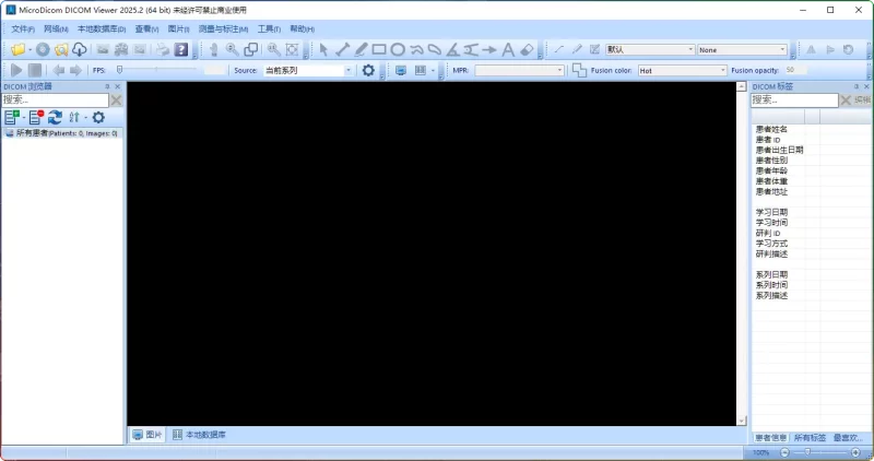 MicroDicom v2025汉化版 - 医学影像DCM文件阅片器 | 免费DICOM查看工具 - 搜源站-搜源站